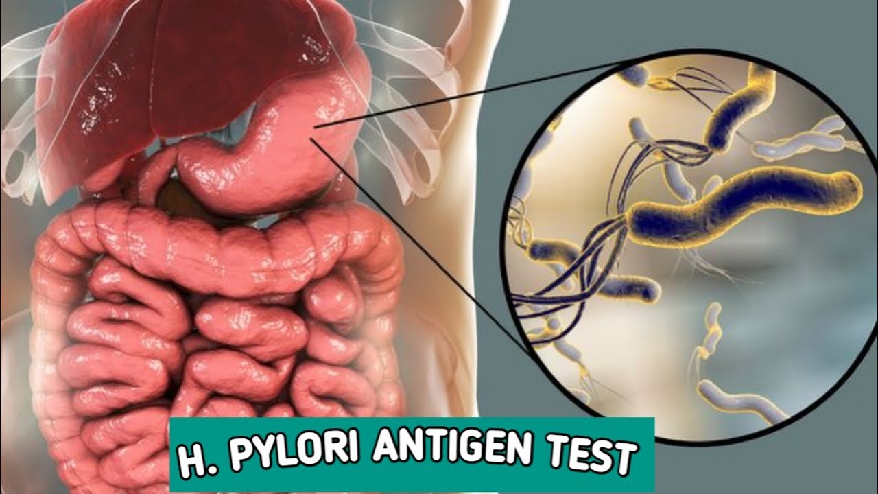 H.Pylori Antigen rapid TEST.MLT WORLD