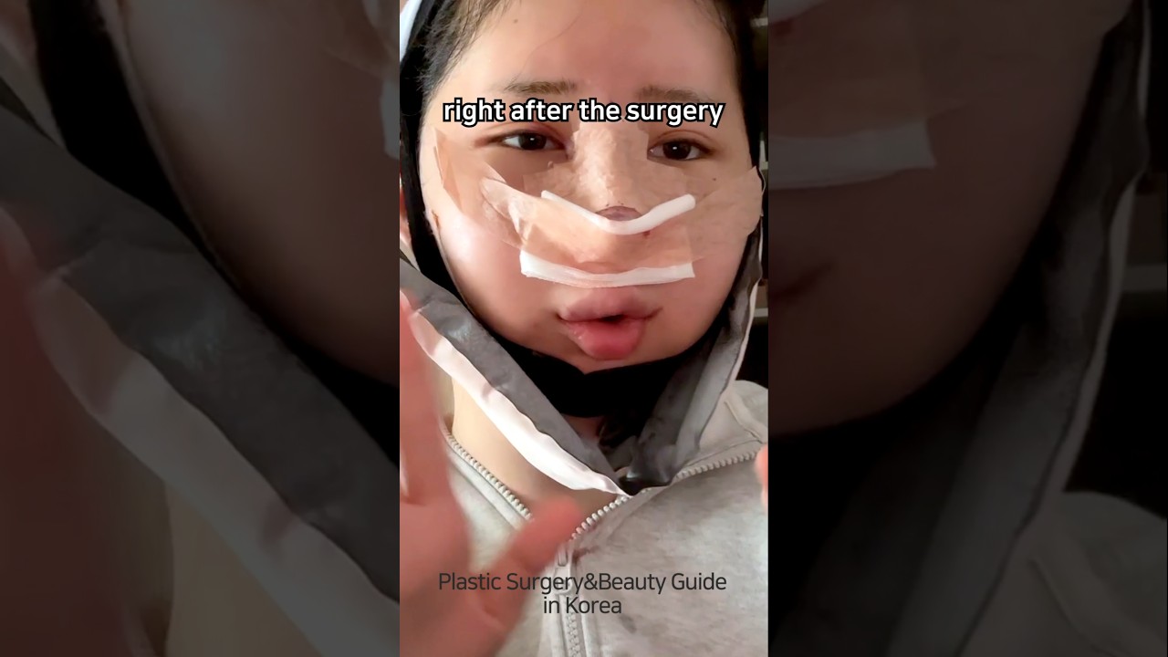 How to become as beautiful as a K-pop idol #glowup #fyp #skincare #korean #beauty #plasticsurgery