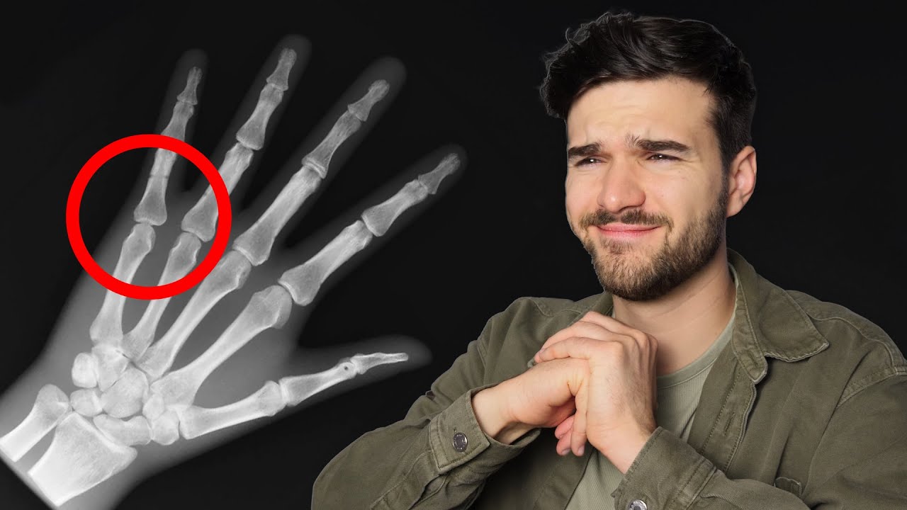 Miért ROPOGNAK az ujjaink? - Márkopédia #24