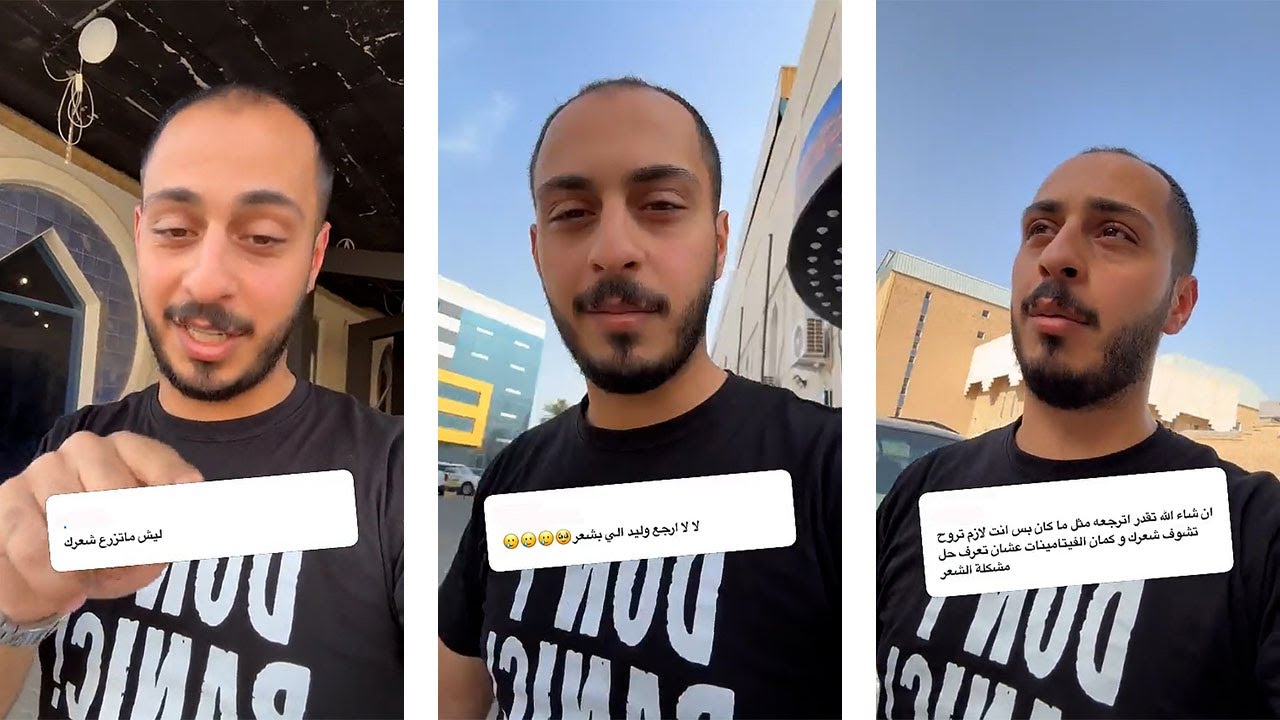 معقول وليد يحلق شعره كامل!