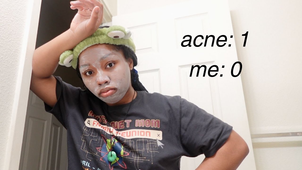 im 23 and still hate my face