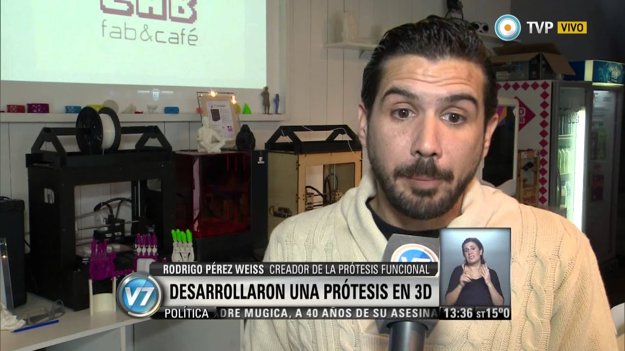 Visión 7: Desarollo argentino: Prótesis funcional de mano en 3D