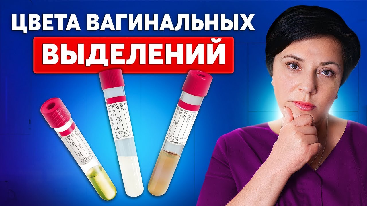 О чем говорит цвет выделений у женщин - Норма или признак инфекции?