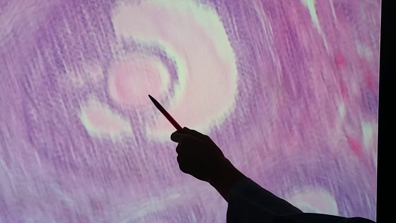 Histologia Ov&aacute;rio