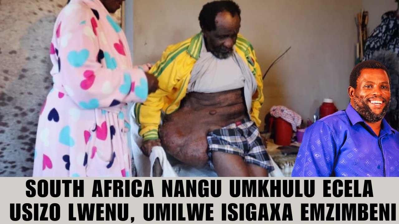 SOUTH AFRICA NANGU UMKHULU ECELA USIZO LWENU, UMILWE ISIGAXA EMZIMBENI