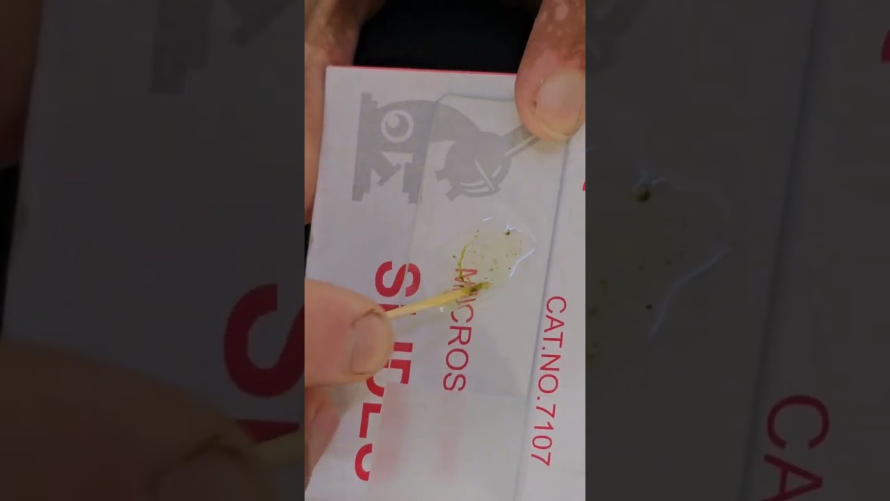 Bird Dropping Under Microscope|| Feacal smear || Test for Coccidia, Giardia , Worms