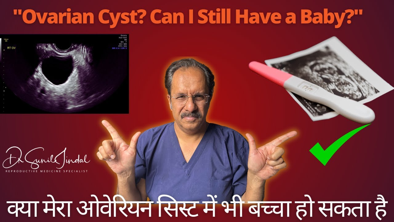The Best Way to Boost Your Fertility Despite Ovarian Cysts|Dr.Sunil Jindal|Jindal Hospital