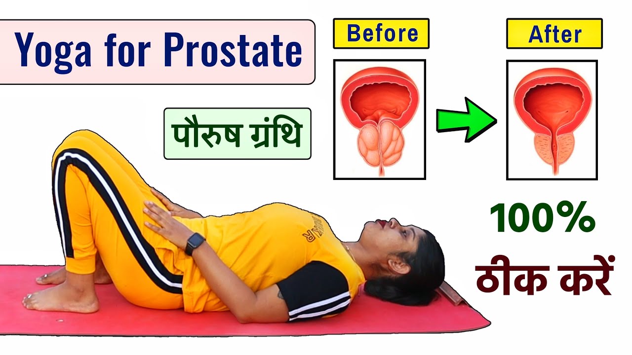 Prostate पौरुष ग्रंथि को ठीक करने के लिए योगासन | Prostate Gland Exercise | @Yogawale