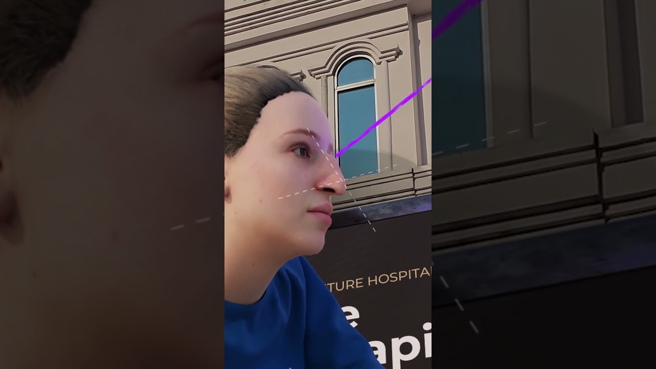 Nose Reshaping at Al-Shifa Future Hospital || Natural Results Beyond Imagination || Gujranwala