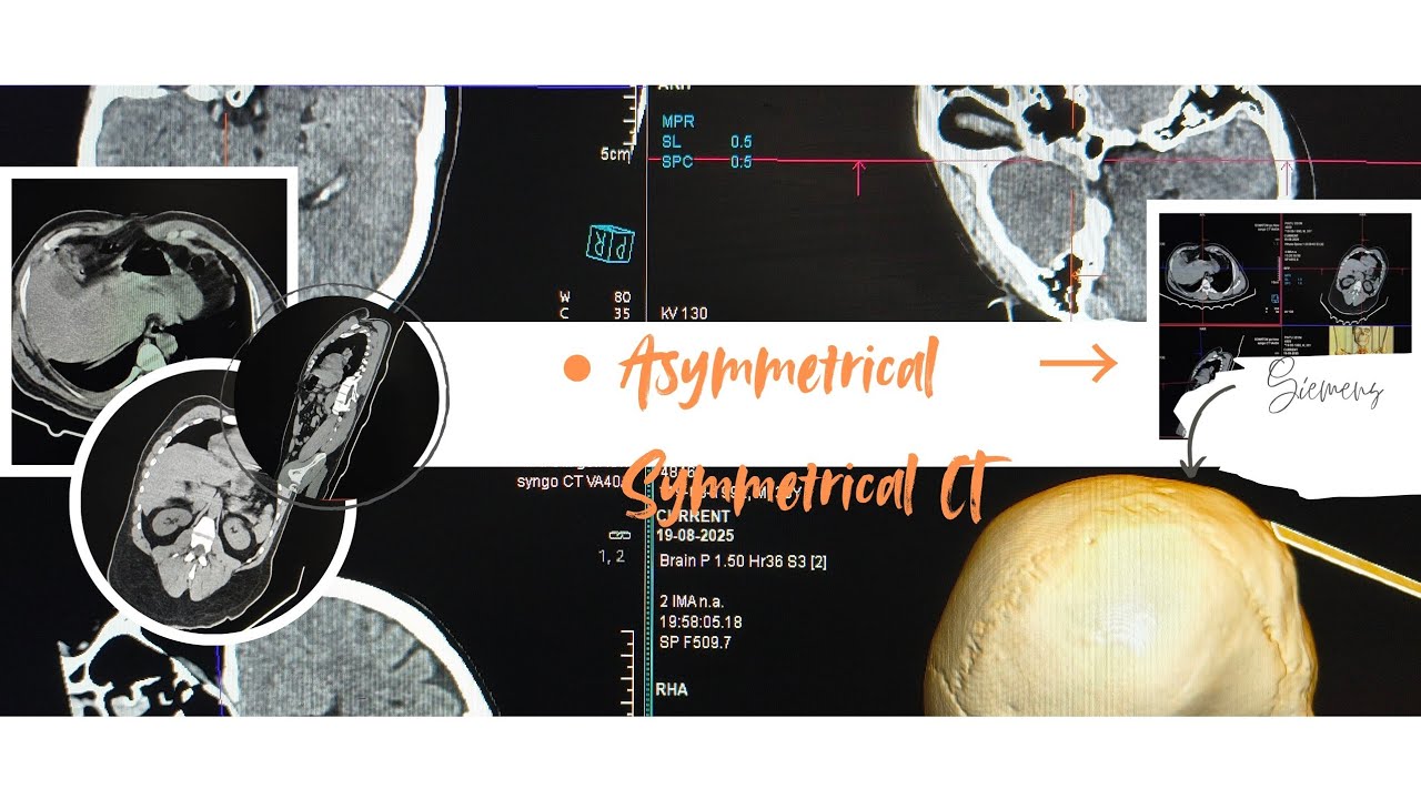 How to Correct Asymmetrical CT Planes to Symmetrical (Axial, Coronal, Sagittal)| Siemens CT Tutorial
