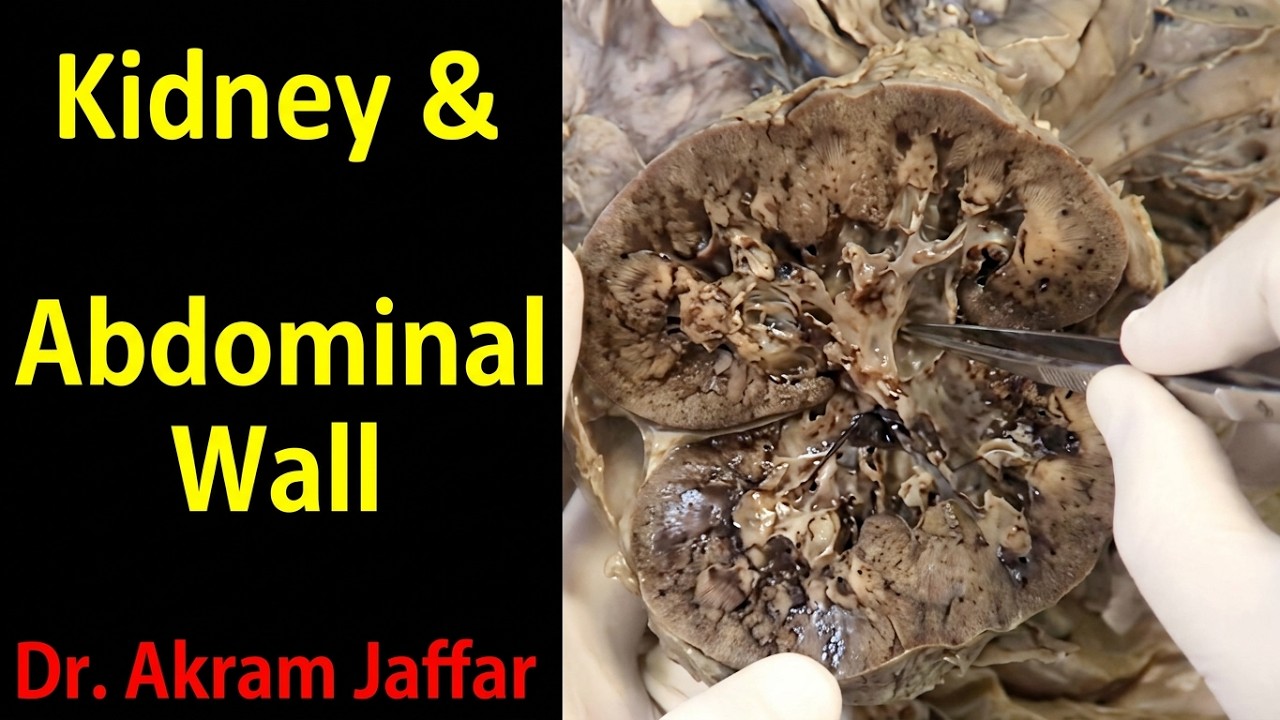 Kidney and posterior abdominal wall - dissection + Anki flashcards