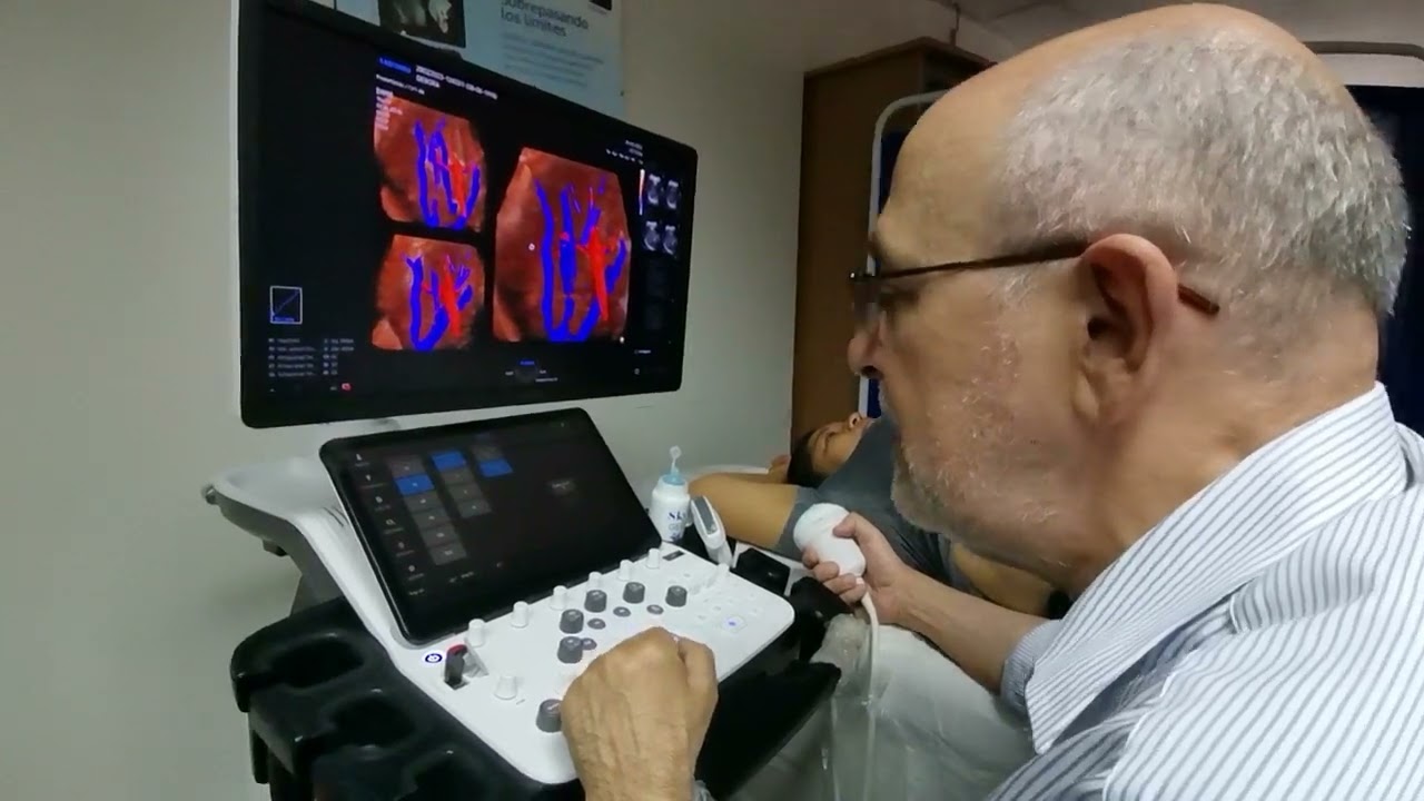 Uso del 3D en Abdomen con el V8 de Samsung. (Abdomen difícil)