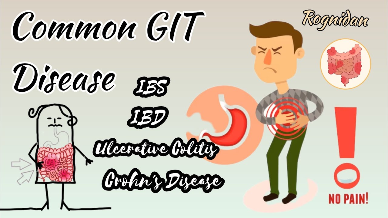 COMMON GIT DISEASE||IBS IBD Ulcerative Colitis Crohn's Disease||RognidanPaper2|| Bams Morden disease