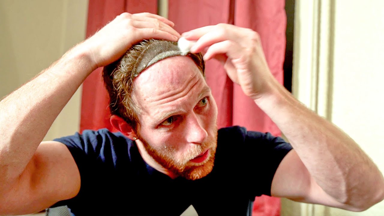EMERGENCY How TO Re-attach Your Lace Hair System | Liquid Adhesive Hair System Install