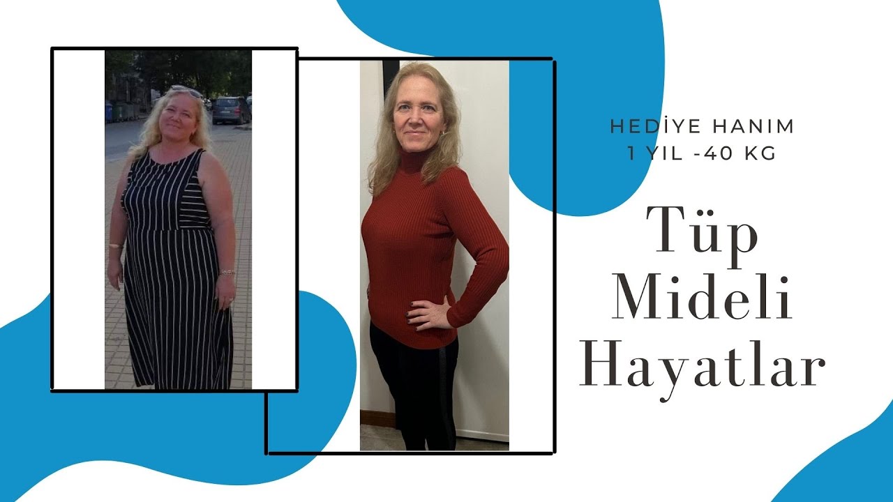Op. Dr. Onur Kesler - Tüp Mideli Hayatlar Tekirdağ - Çorlu Obezite Cerrahisi #tüpmideameliyatı