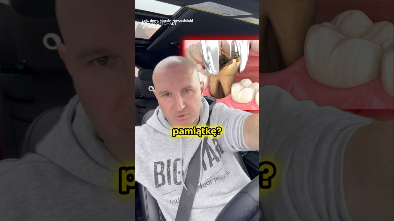 Dlaczego NIE Dostaniesz Wyrwanego Zęba! 😲😱
