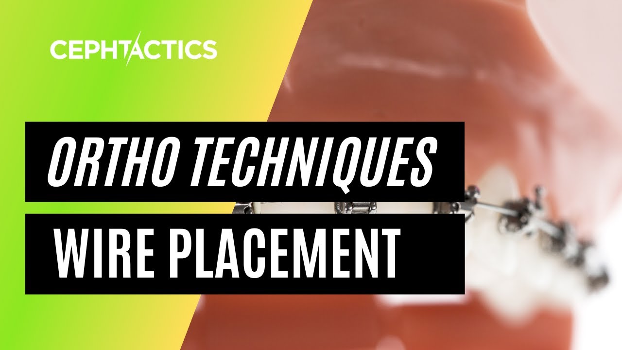 Wire Placement in Orthodontics