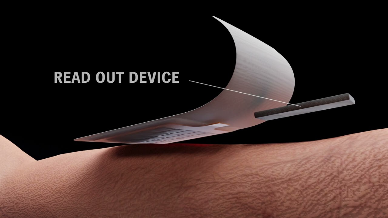 SmartPATCH for wound monitoring
