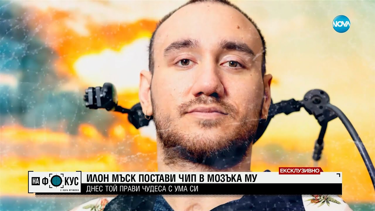 ЕКСКЛУЗИВНО: Говори първият човек в света с чип в мозъка