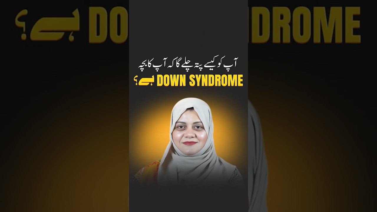 How to Know If Your Child Has Down Syndrome | Early Signs Every Parent Should Watch