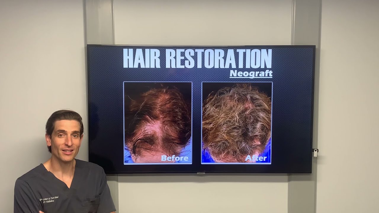 Aesthetic procedures for MEN ONLY!