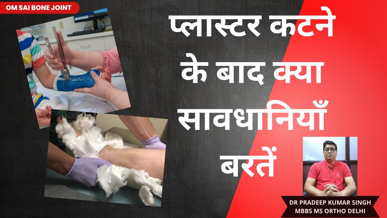 प्लास्टर कटने के बाद क्या सावधानियाँ बरतें/Dr. Pradeep Kumar Singh
