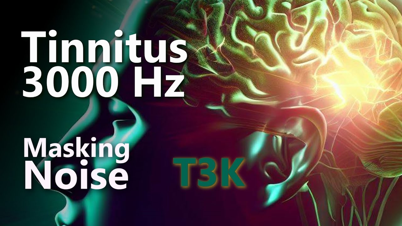 Tinnitus T3K 3000 Hz Noise Masking Might Relieve Your Ringing