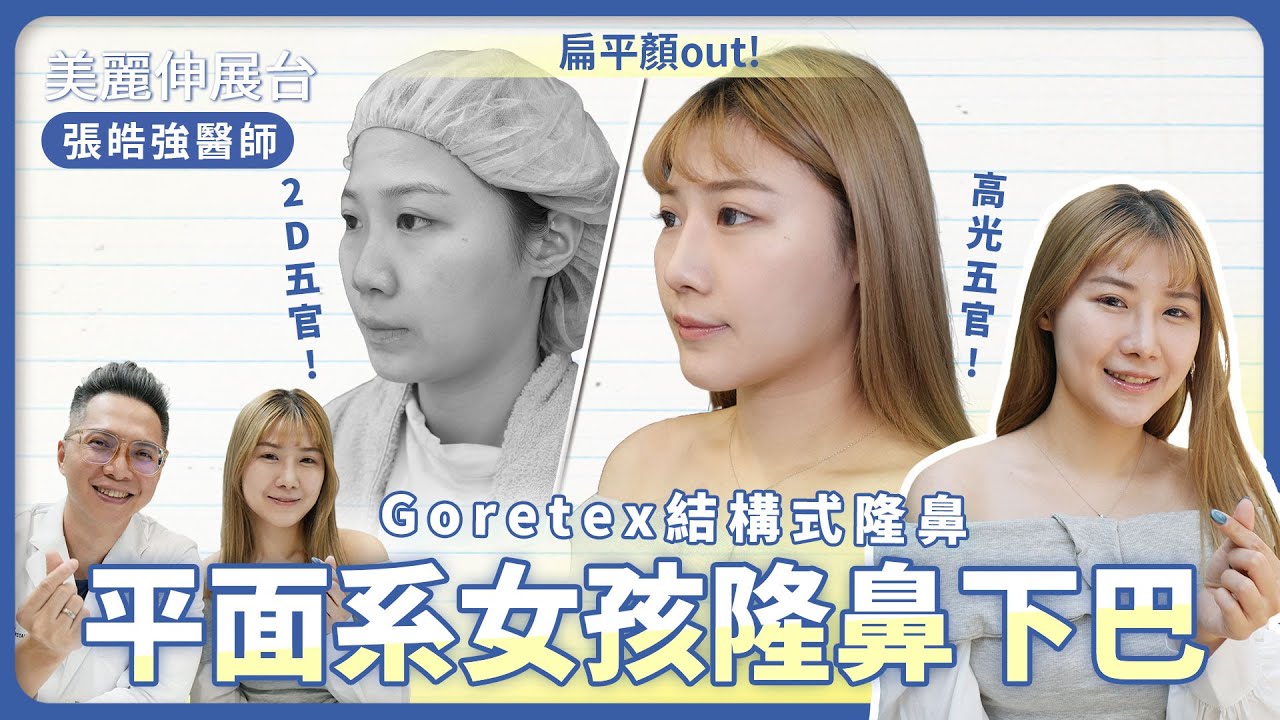 【隆鼻下巴】平面系女孩的高光時刻  立體自信Up- 優越診所-張皓強醫師