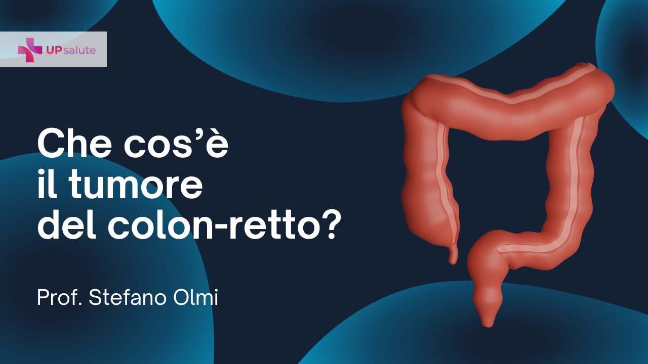 Tumore del colon-retto - Prof. Stefano Olmi - UPsalute Channel