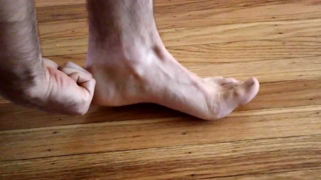 short foot posture explanation