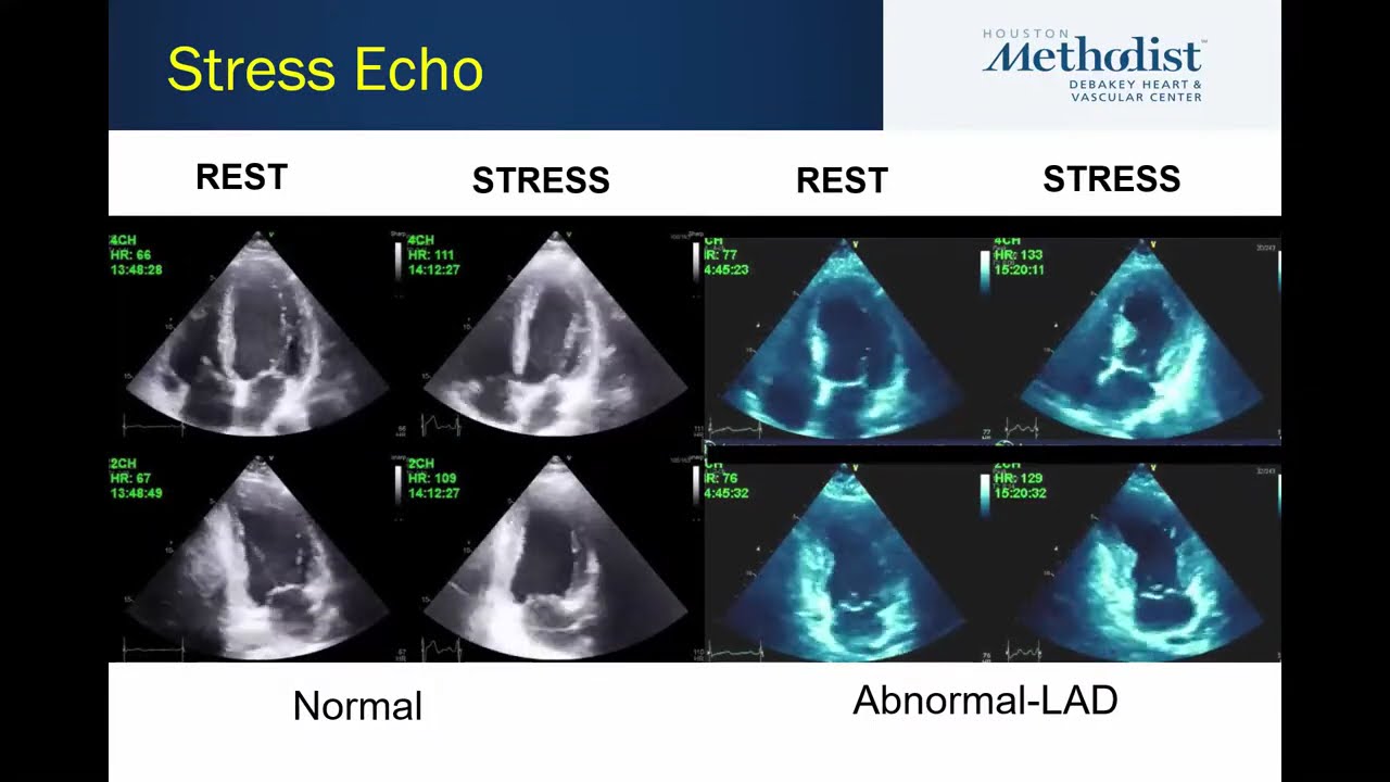 1.6.26 Multi-Modality Imaging Weekly Webcast