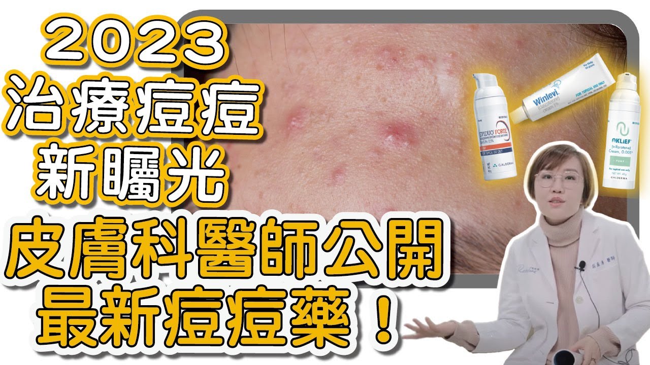 大家都在詢問的新青春痘治療用藥！居然可以避免痘痘變成痘疤？它是如何治療青春痘的？