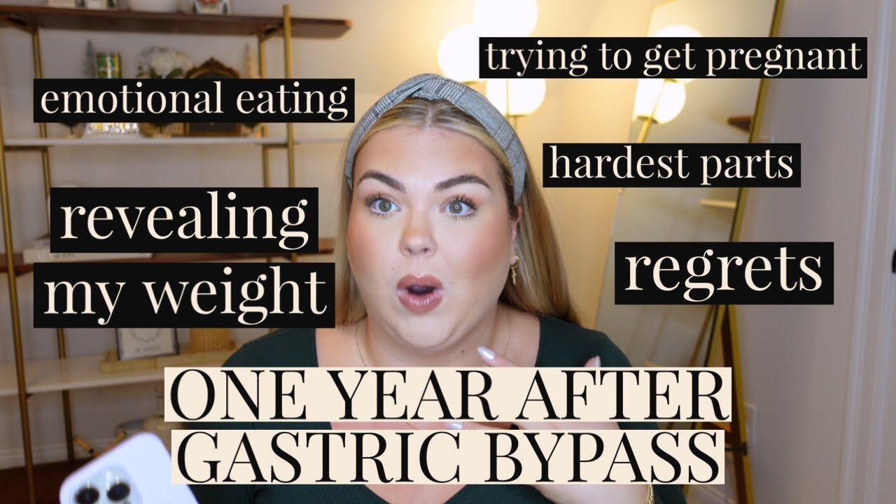 ONE YEAR AFTER GASTRIC BYPASS UPDATE