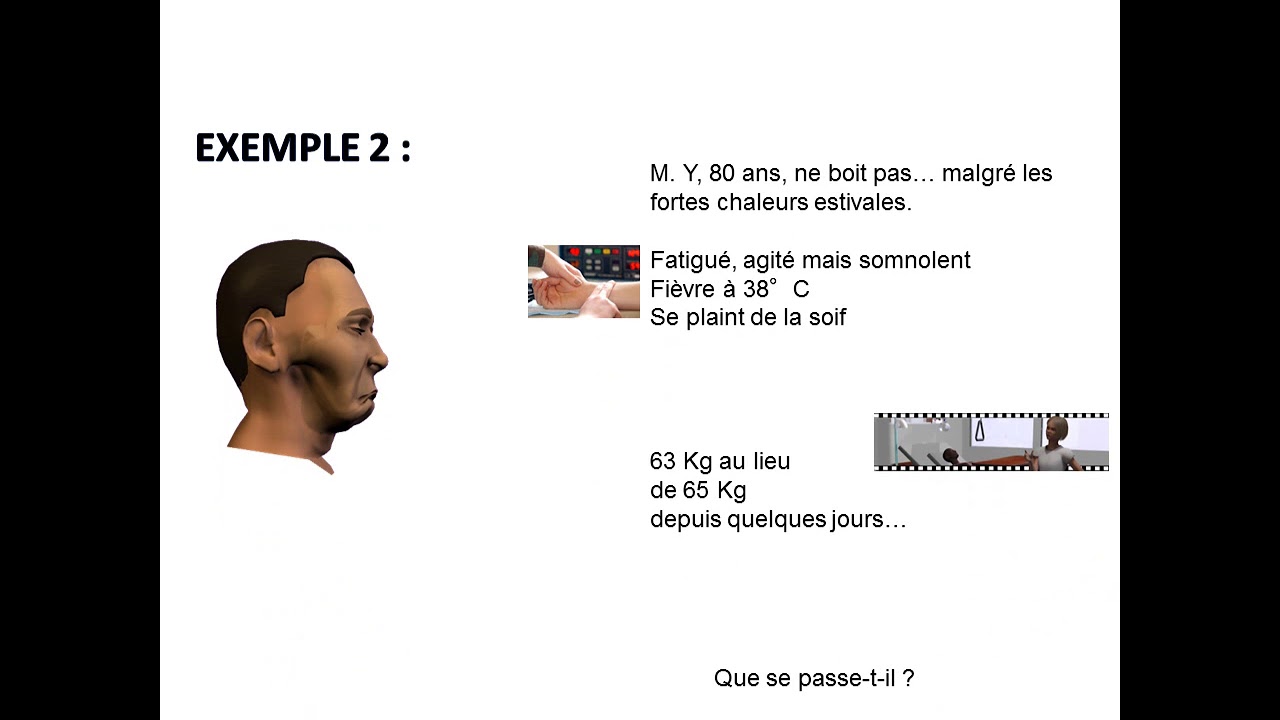 Déshydratation Intra et extra-cellulaires