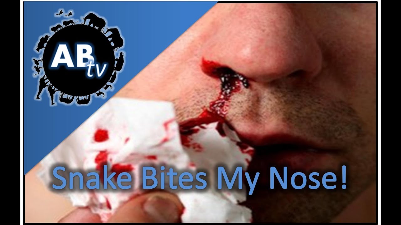 Snake Bites My Nose! SnakeBytesTV : AnimalBytesTV