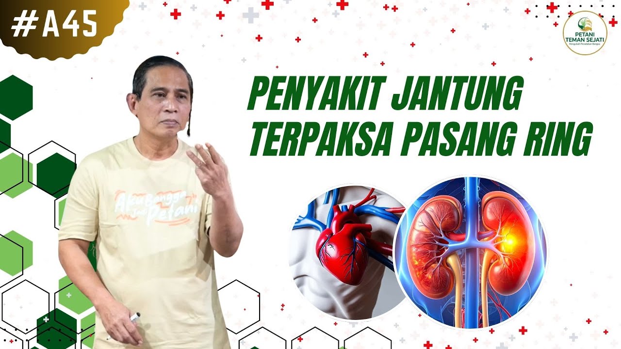 Solusi Penyakit Jantung Hingga Terpaksa Pasang Ring