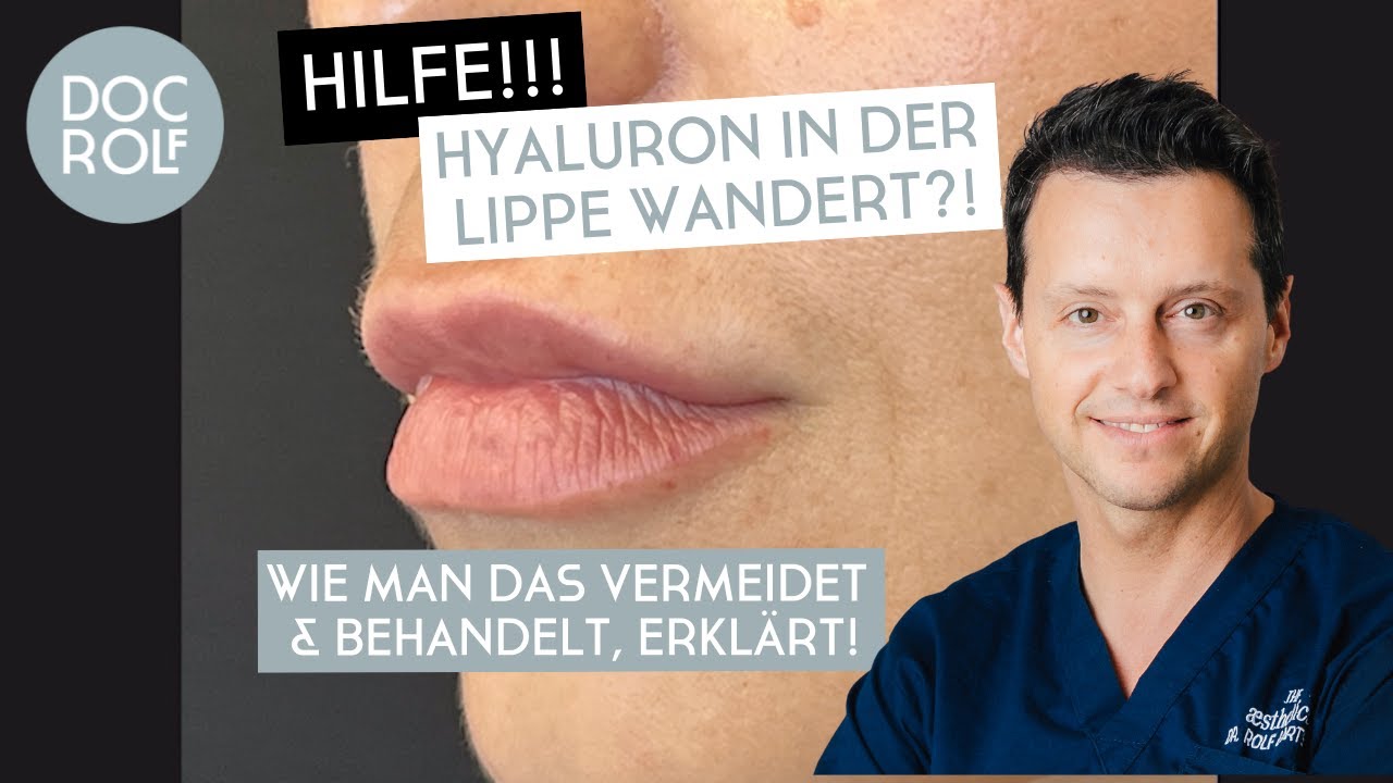 HILFE!!! HYALURON in den LIPPEN WANDERT nach oben?! – Dr. Rolf Bartsch