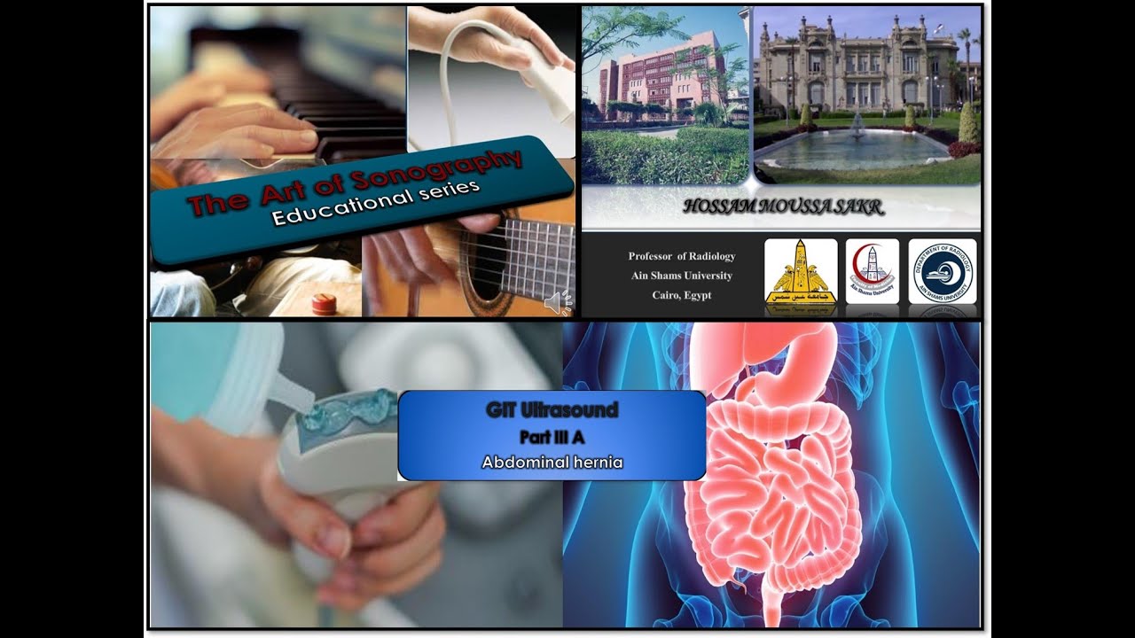 GIT US PART III A ABDOMINAL HERNIA