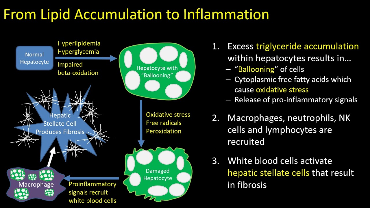 Hepatic Steatosis Part 1: Pathophysiology