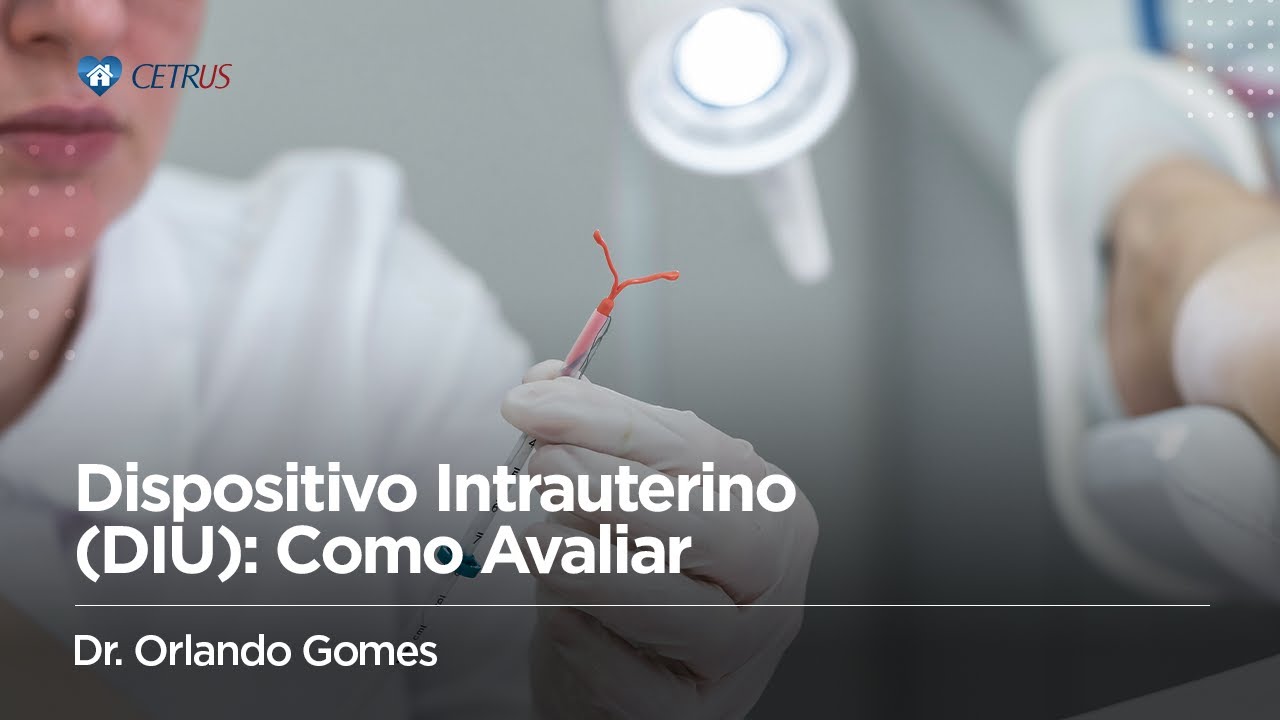Dispositivo Intrauterino (DIU): Como Avaliar | Dr. Orlando Gomes