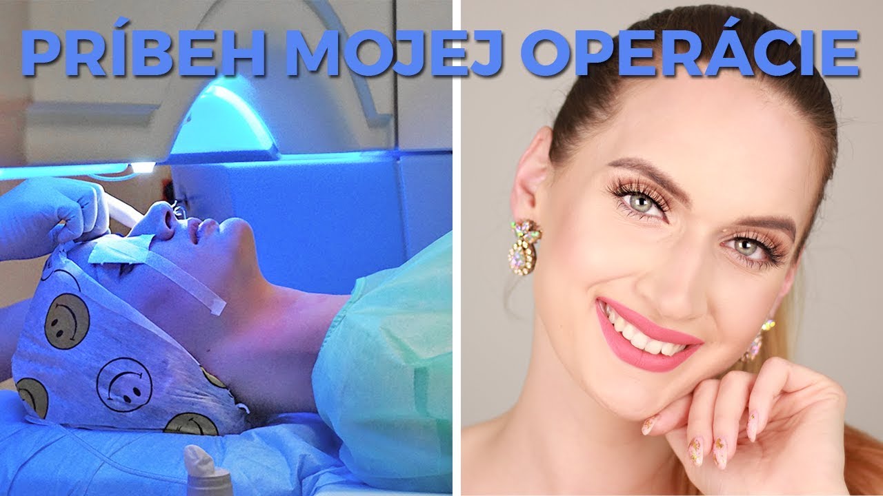 AKO SOM PREŽILA OPERÁCIU OČI? 👀