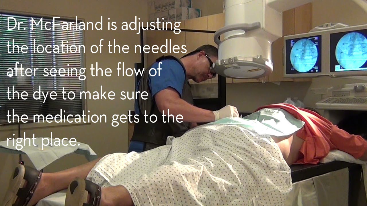 Lumber Epidural Steroid Injection