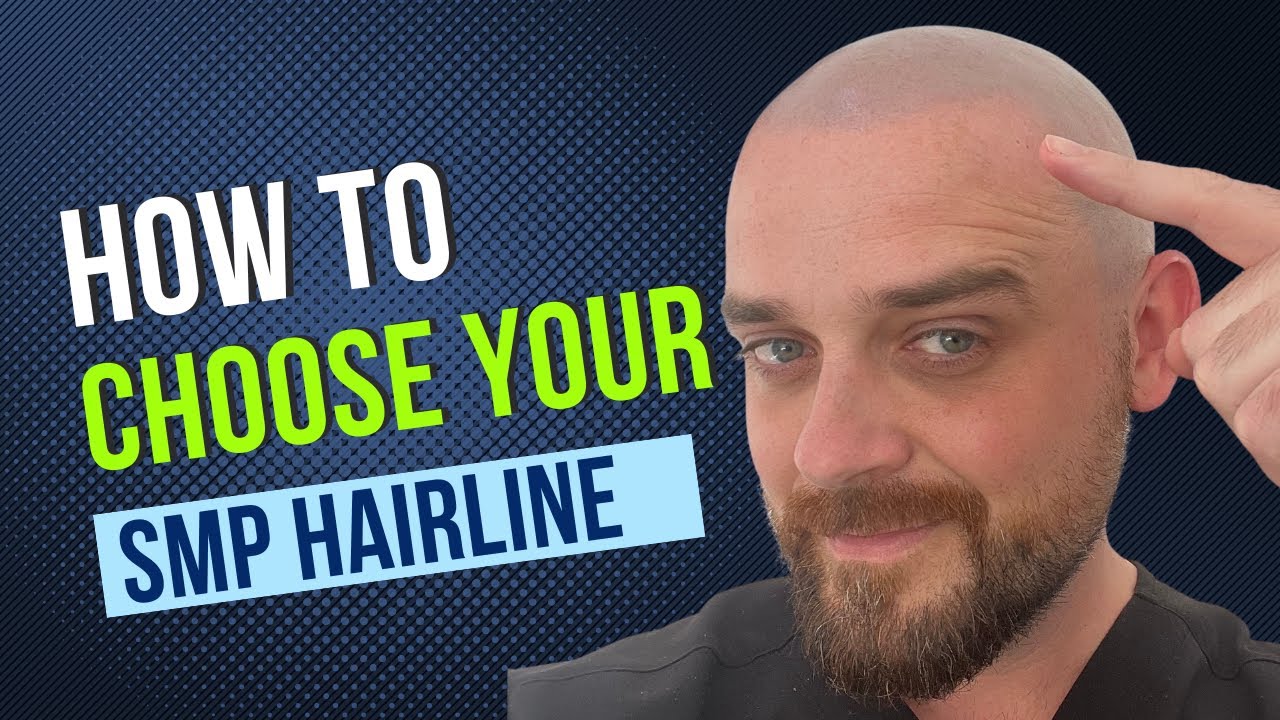Which SMP hairline is right for you?