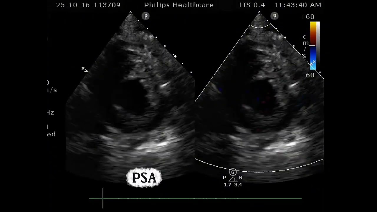 2D echocardiogram examination views #2decho #viralvideo 