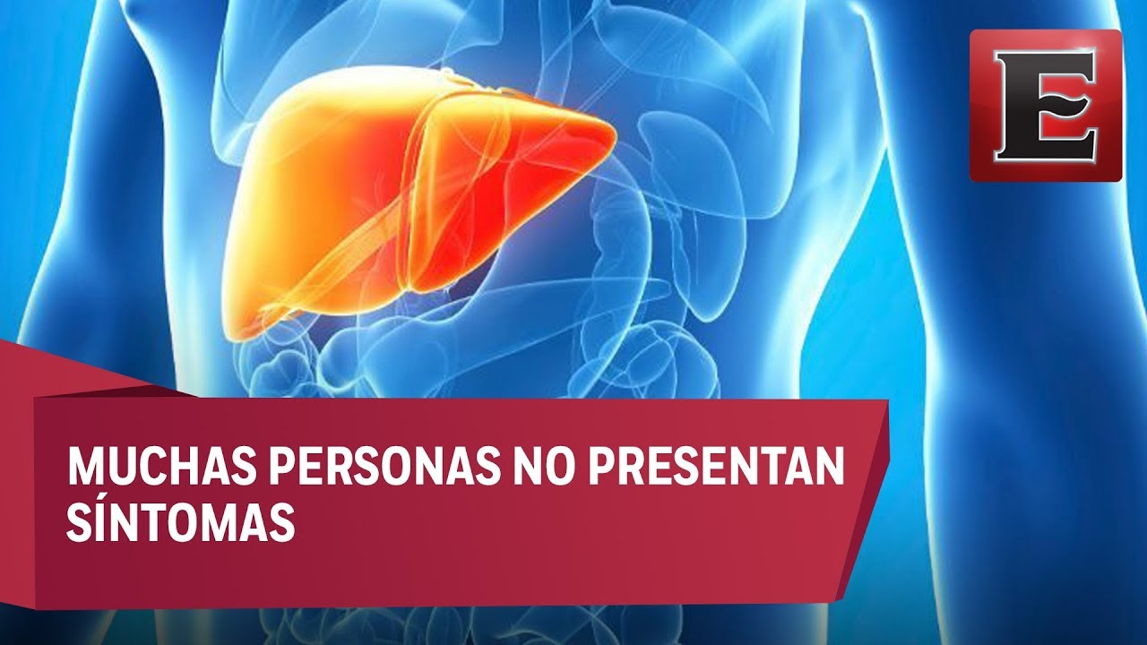 ¿Qué es y cuáles son los síntomas y tratamiento de la hepatitis C?
