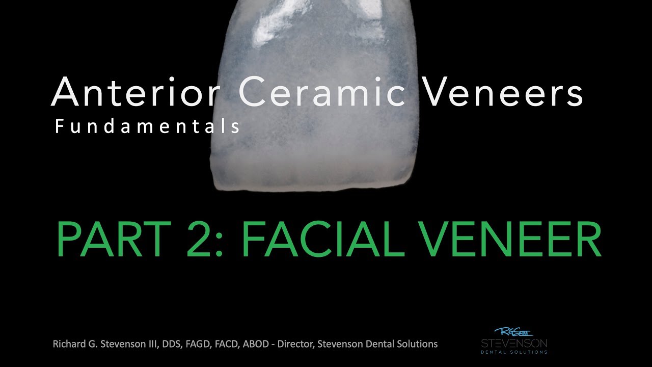 Anterior Ceramic Veneers, Part 2: Facial Veneer