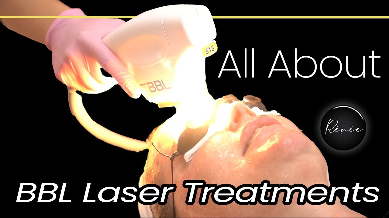 What is a BBL Laser Treatment? | Rêvée Aesthetics | It's not actually a Laser at all