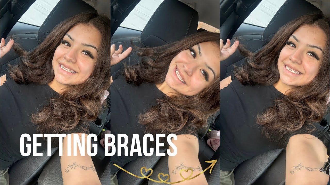 Impulsively getting BRACES (real + raw vlog)