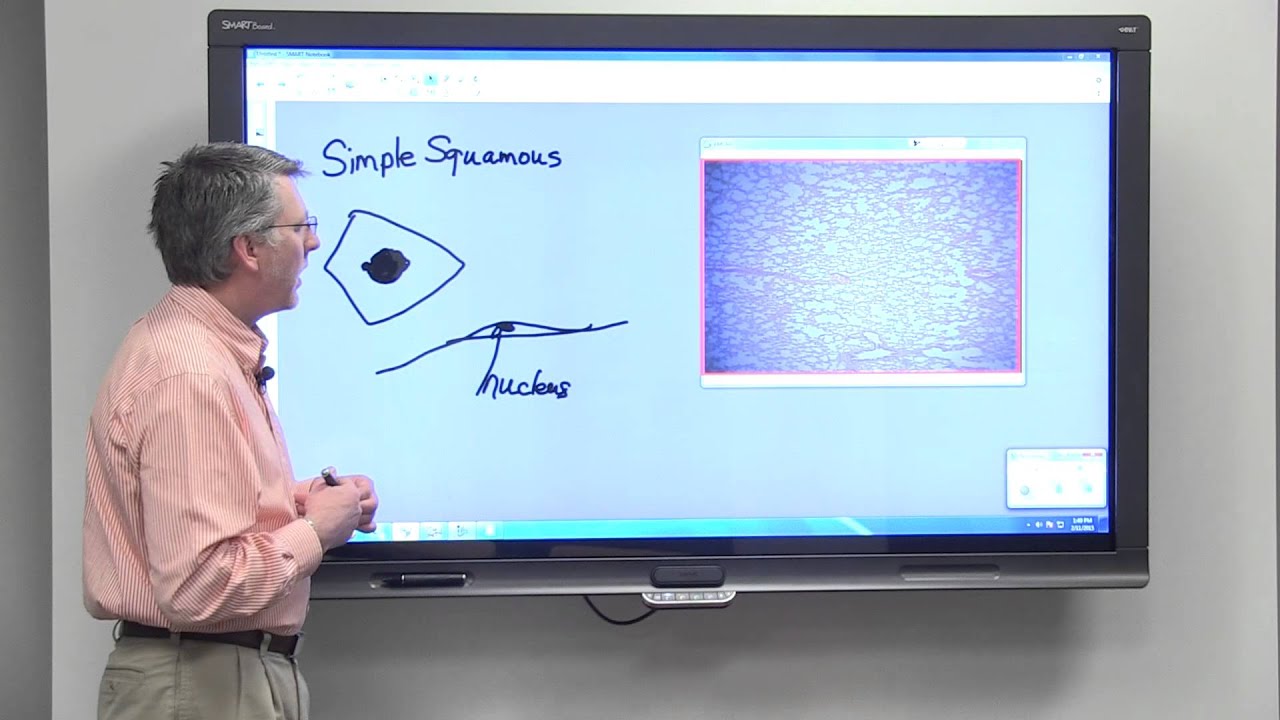 Simple Squamous Epithelial