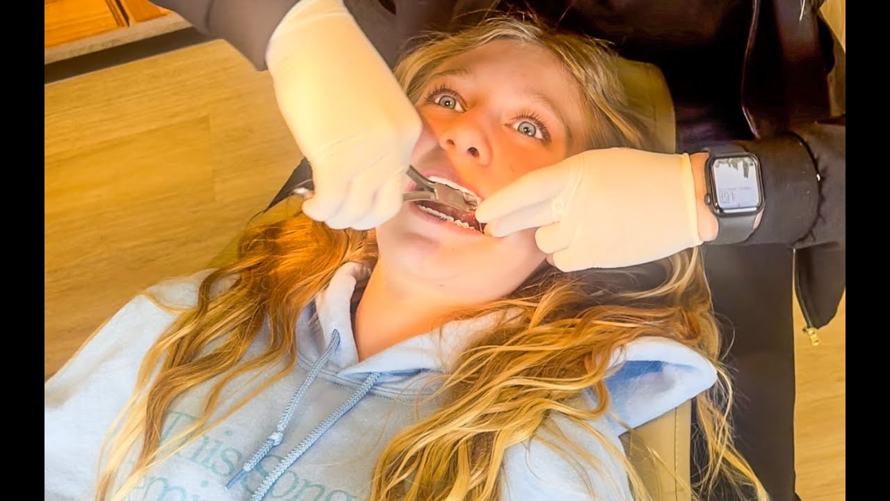 SHE got her BRACES OFF!
